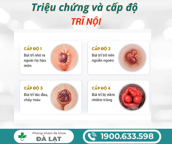 Hình ảnh minh họa